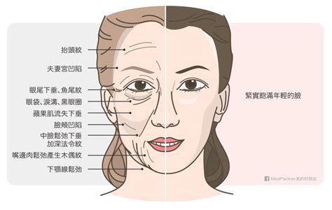 法令紋面相|「法令紋」面相類型圖文解析